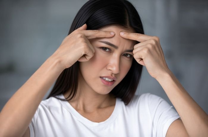 Apa yang Sebenarnya Harus Dibuktikan dari Klaim ‘Non-Comedogenic’?