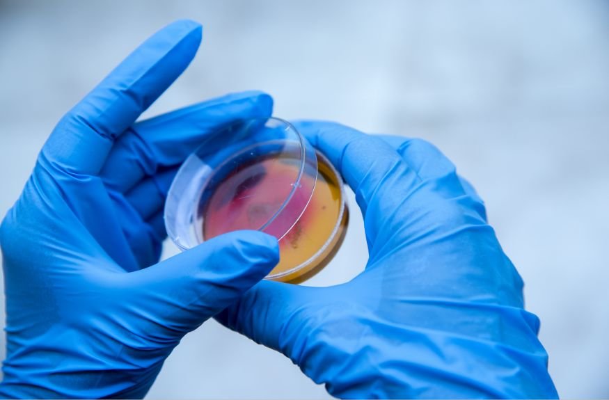 Uji Tantang Mikroba [Challenge Test]: Menguji Ketahanan Sistem Pengawet dalam Produk Kosmetik